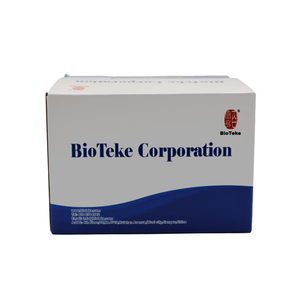 Kit de extracción de ácido nucleico de diagnóstico molecular eficaz