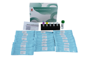 Kit de detección de genotipado del papiloma humano del VPH (método de PCR de fluorescencia) 