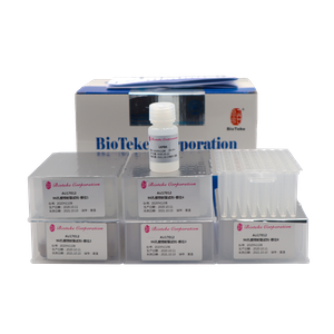 AU17011/17012 Kit de extracción de ácido nucleico de ADN viral de ADN preempaquetado (perlas magnéticas)