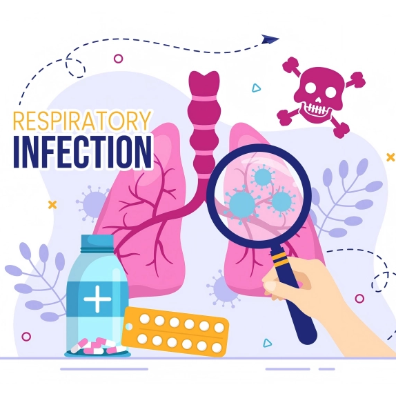 Cómo adoptar estrategias de detección eficientes durante el período epidemico de enfermedades respiratorias？